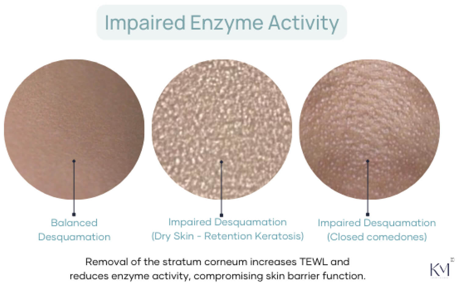 Impaired Enzyme Activity